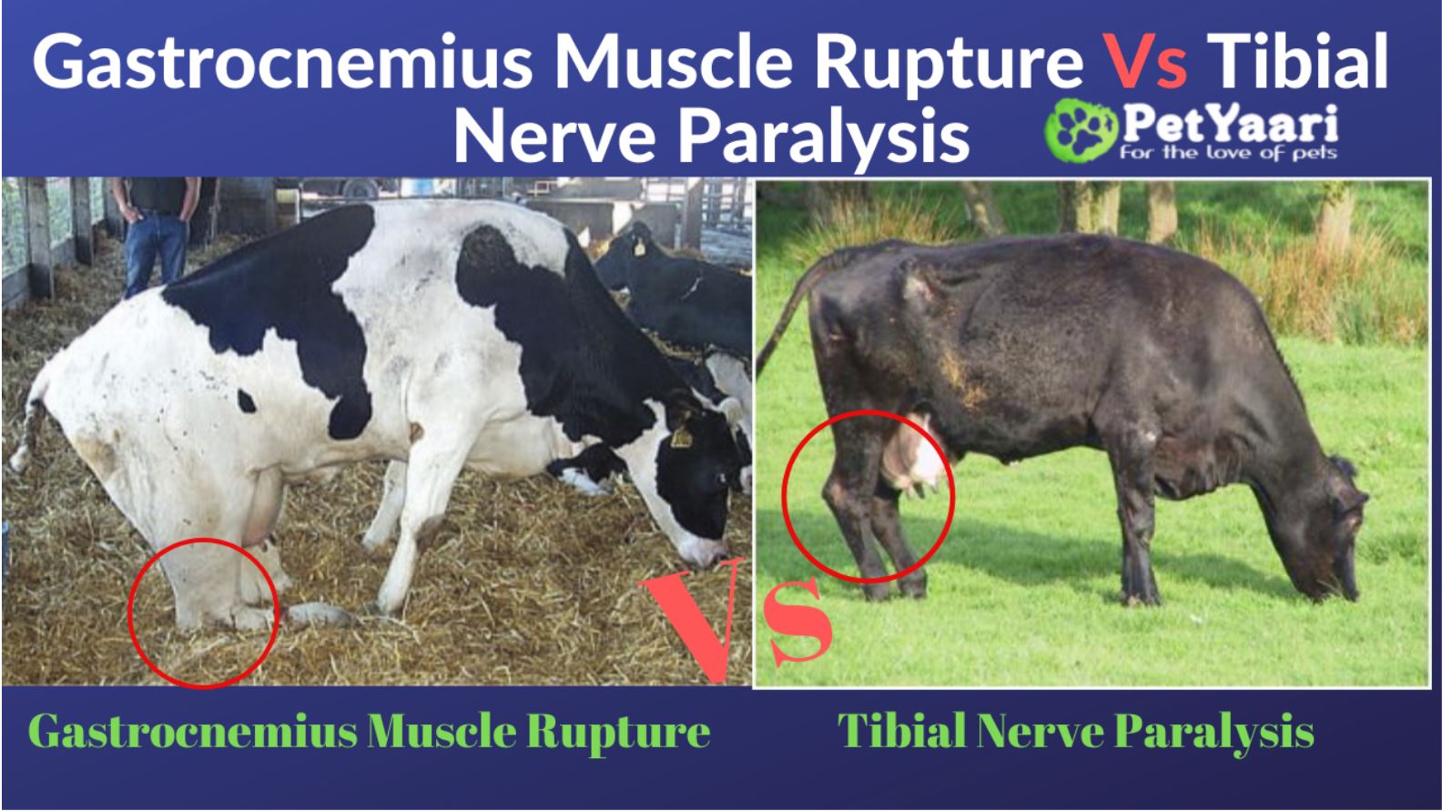 Gastrocnemius Muscle Rupture Vs Tibial Nerve Paralysis