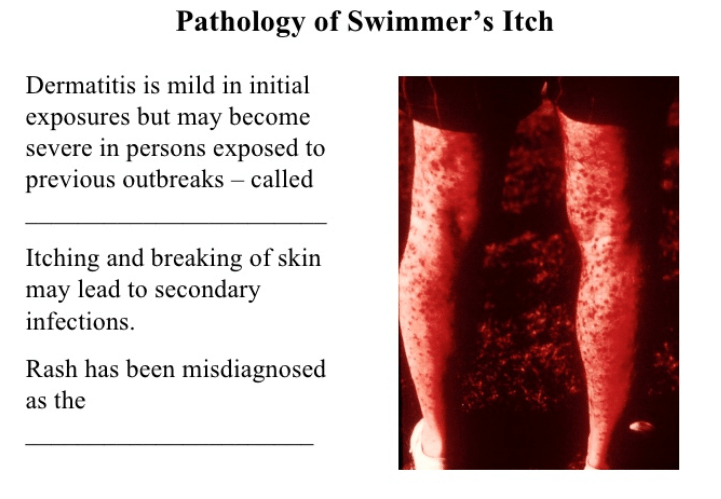 Swimmers Itch 1 1 • Veterinary Parasitology ( Trematodes & Cestodes) Part 1